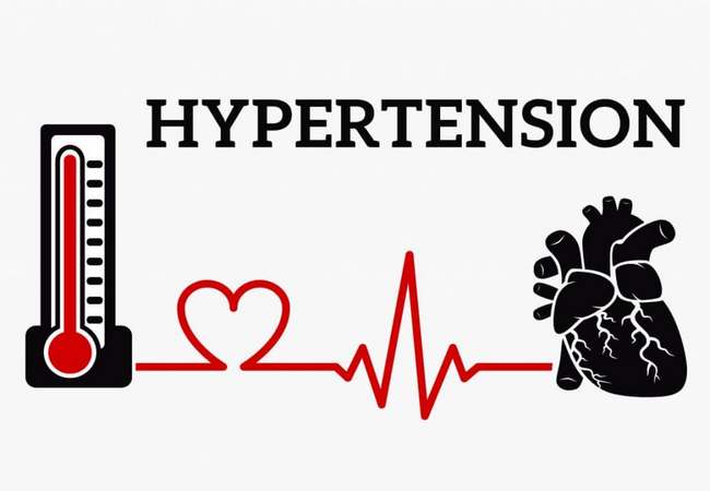 Causes of hypertension (HTN)