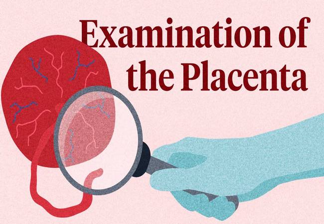 Placenta examination procedure