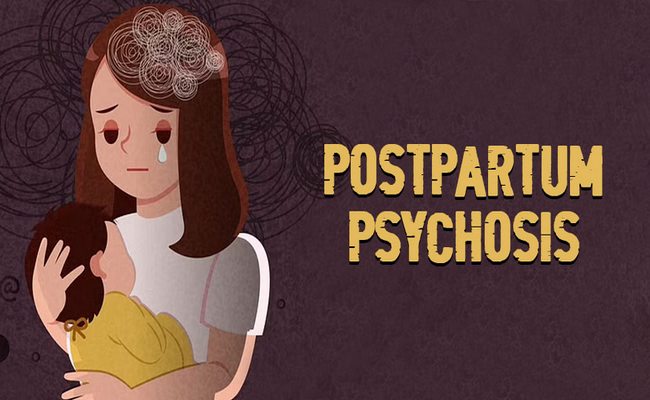 Postpartum psychosis symptoms